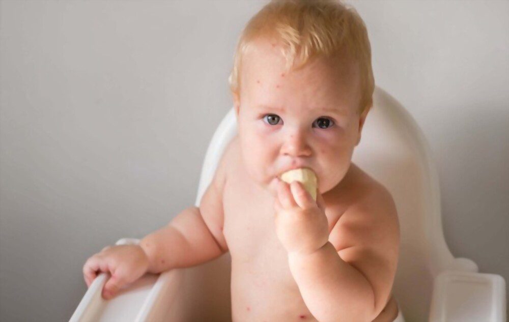 A small baby eating a banana has banana allergy symptoms.