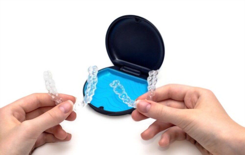 Can I get Invisalign only on the top Teeth? Transparent aligners for top and bottom teeth.