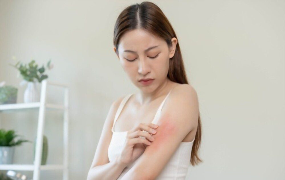 A young woman itching on arm due to red dye allergy.