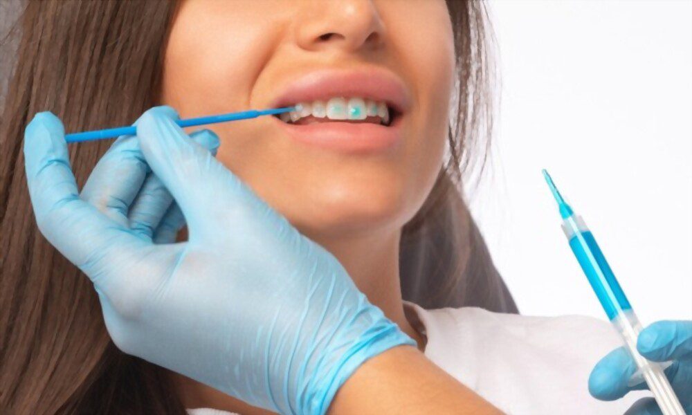 The dentist doing a teeth whitening treatment in the clinic for a young beautiful woman.