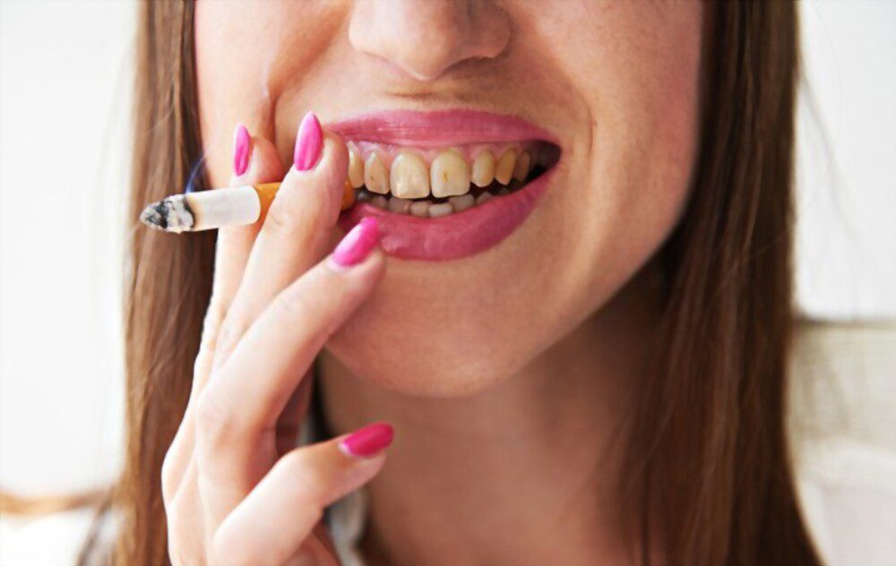 A woman with dirty teeth is smoking.