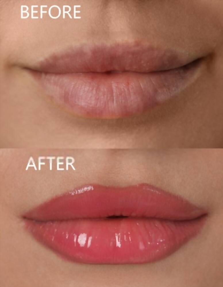 Uneven lip tone before and after