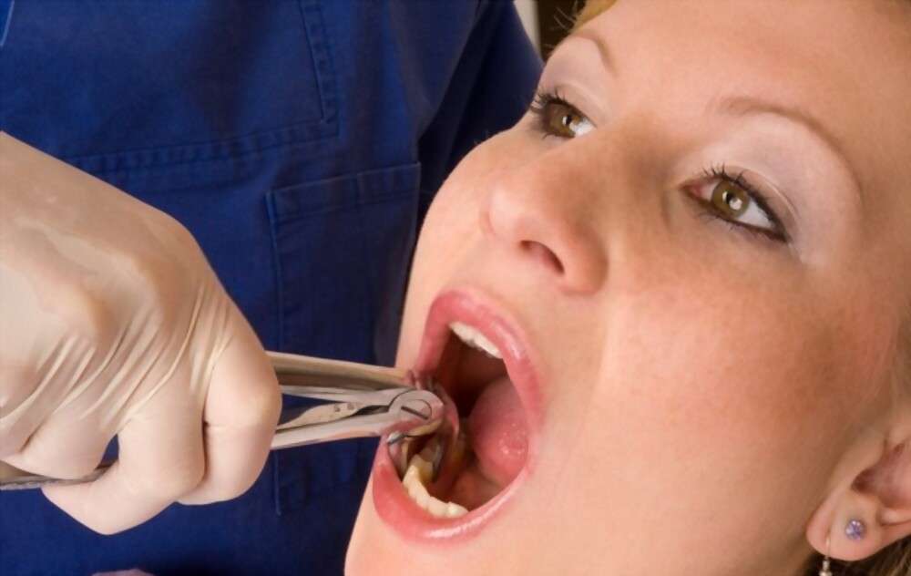 A dentist is performing tooth extrusion procedure
