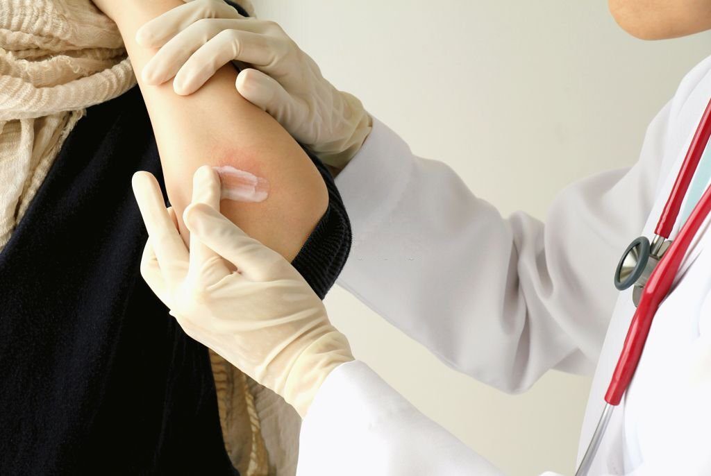 A doctor applying triderm cream on a female patient's affected body part.