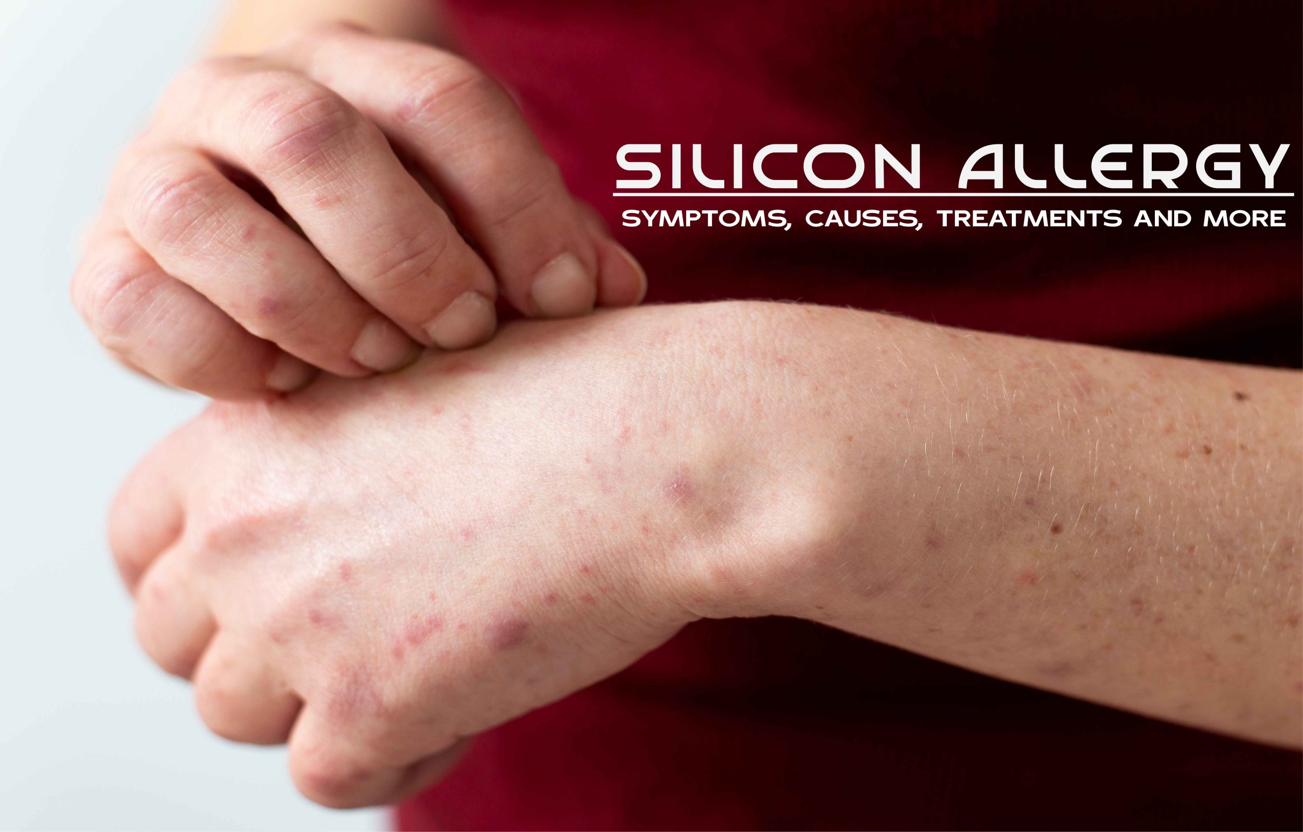 Silicone Allergy Everything You Need To Know AllergiesInfo